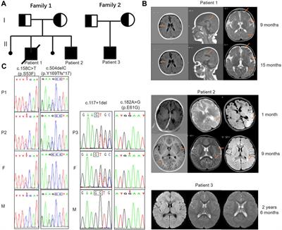 Exome sequencing identified novel variants in three Chinese patients with 5,10-methenyltetrahydrofolate synthetase deficiency